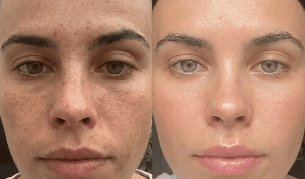 Chloe R., 38 result