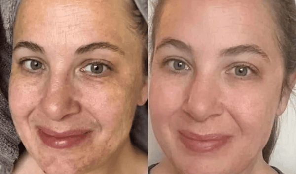 Alex F., 43 result