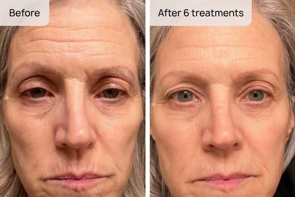 Helena, 51 — Dublin result
