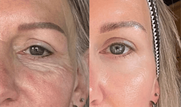 Helen M., 49 result