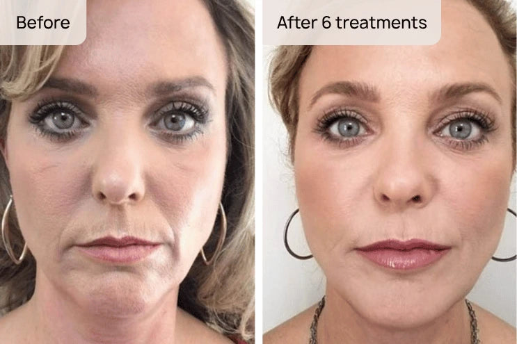 Restore Your Natural Glow
