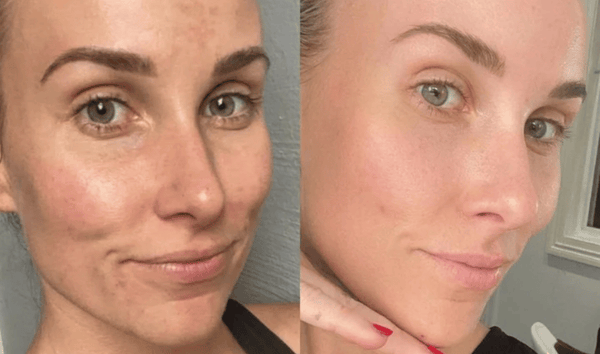 Sarah J., 45 result