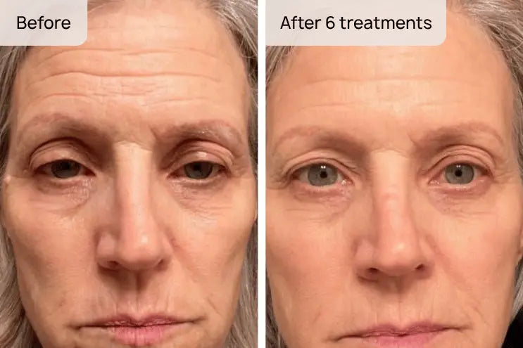 Soften Fine Lines & Wrinkles
