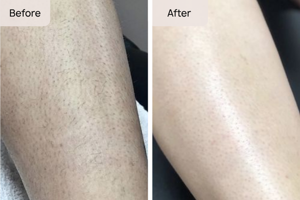 Rachel T. result