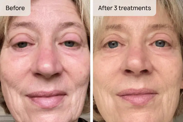 Catherine, 58 — Bath result