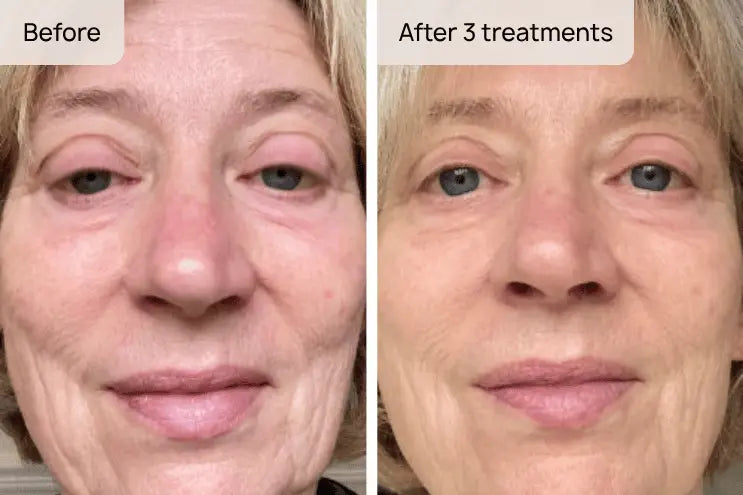 Karen, 60