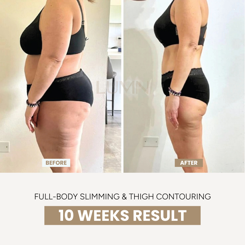 BodySculpt 2.0™ Contouring Massager