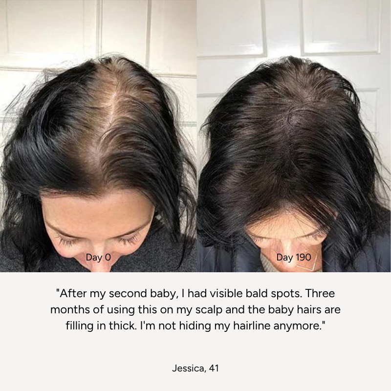 High-Frequency Wand™