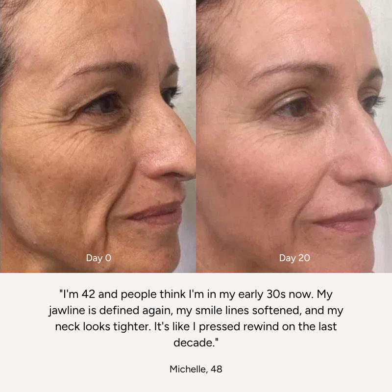 High-Frequency Wand™