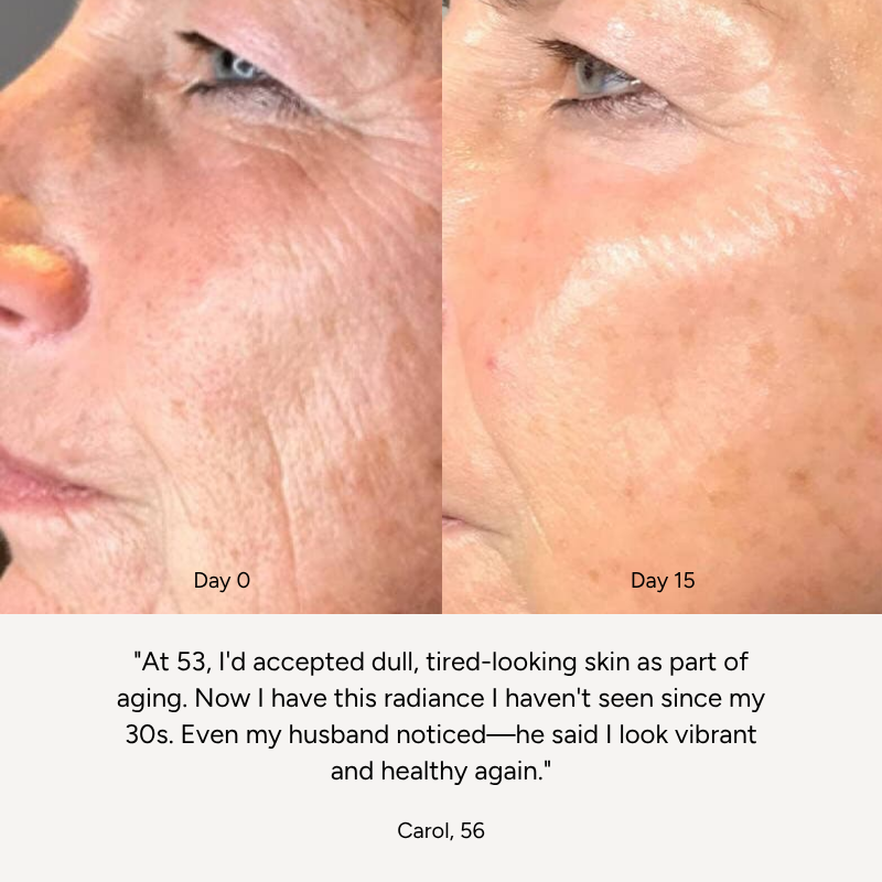 High-Frequency Wand™