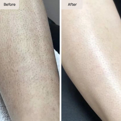 Hair Removal Foam