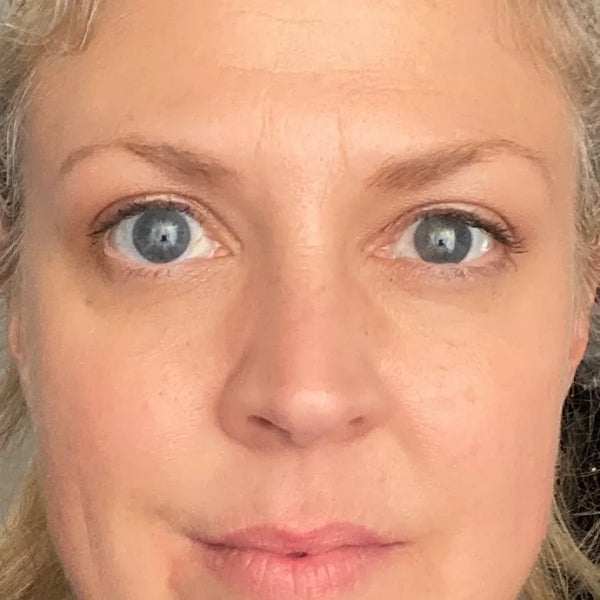 After treatment - Monique, 48