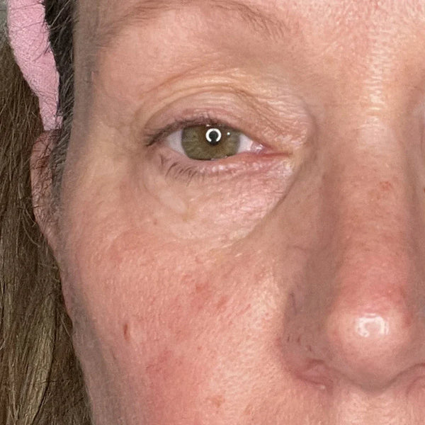 After treatment - Sarah, 56
