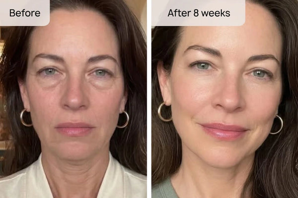 Karen M., 48 result