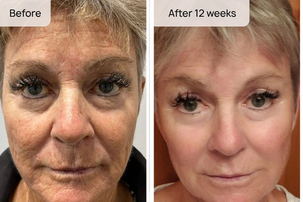 Linda L., 62 result