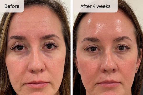 Rachel T., 39 result