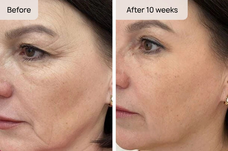 restoration susan 10wk